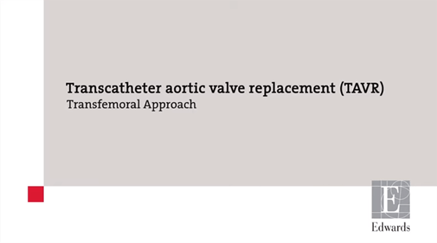 Beginning of the TAVR Transfemoral Approach video